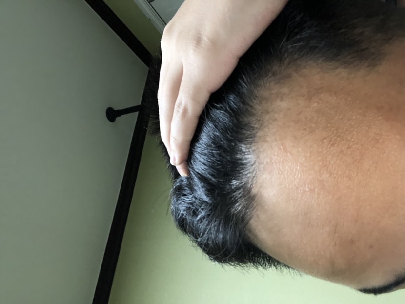 앞