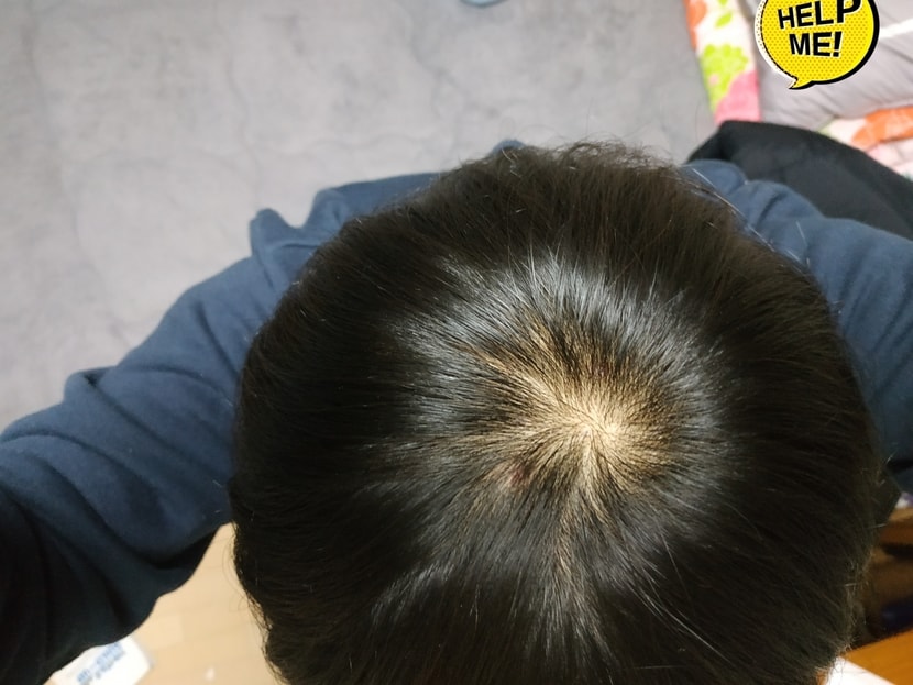 1달 후