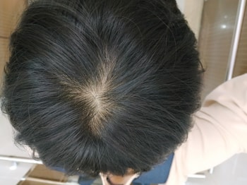 바르기 전