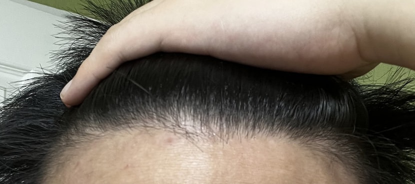 앞머리