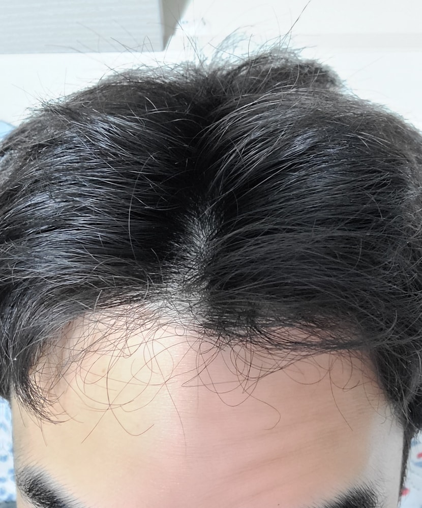 위에