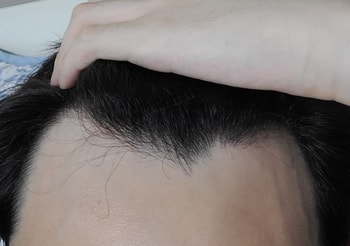 M자 심각