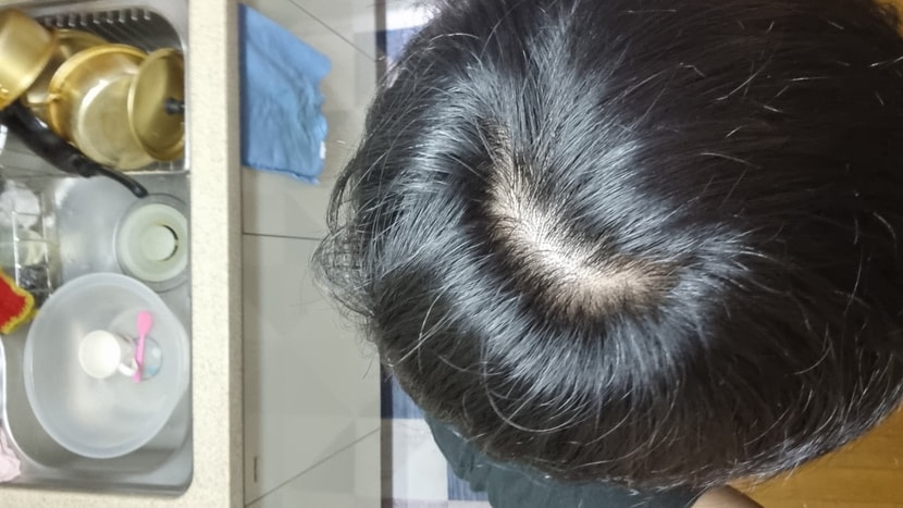 지금2