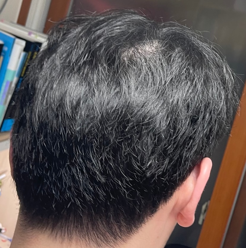 4개월 후