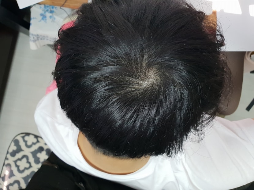 이게 좀 심해보인다