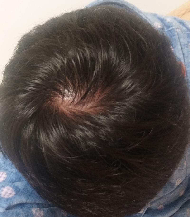 님들 이거 많이 심한거같나요??