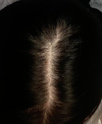 정수리