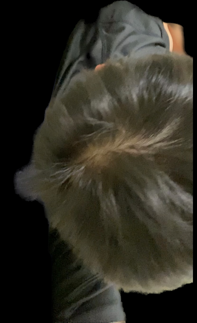 현재 두피