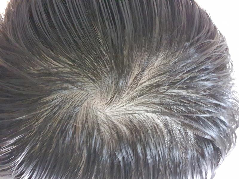 薄毛あってるよね？