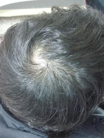 머리넘길어서 자르려는데 20대초반남자가 이런머리면 숙덕거릴거같고 심적압박느끼는데 너희들은 어떤생각을가지고 미용실가? ㅋㅋ  ㅠ