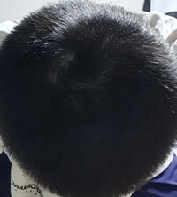 정수리