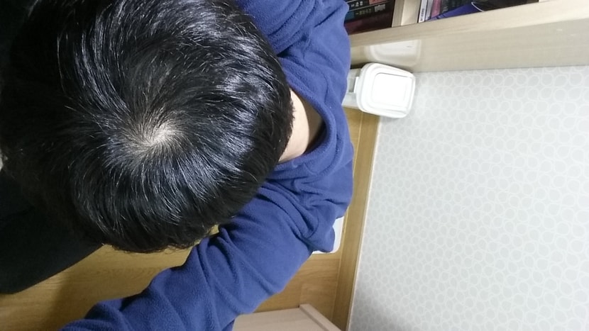 정수리1