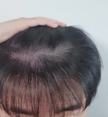 윗머리 손으로 들어 올린 겁니다