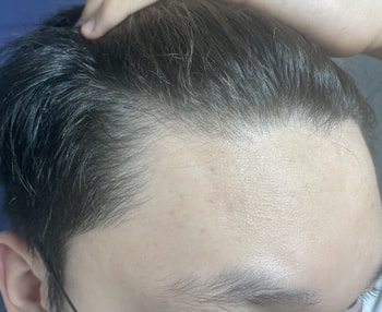 오른쪽