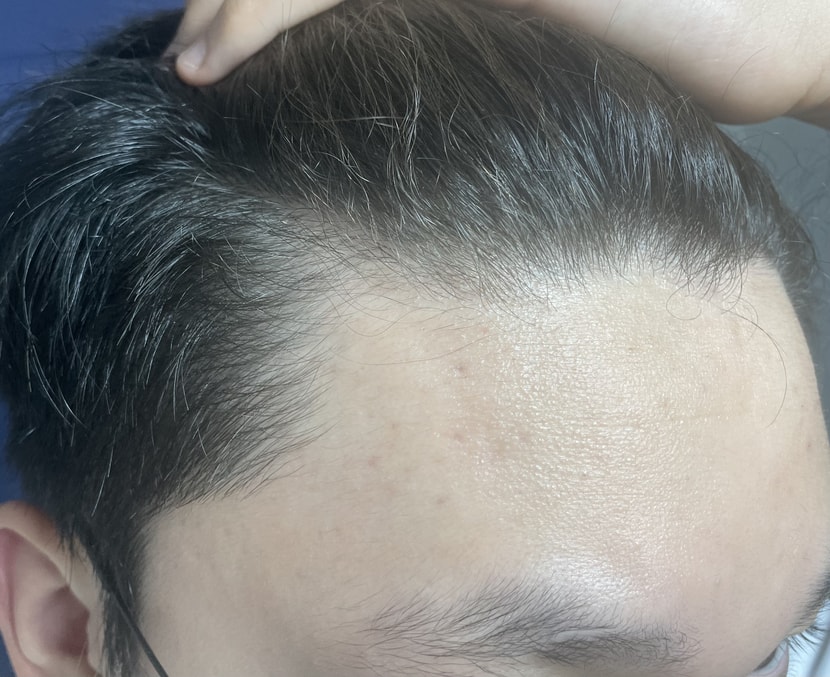 오른쪽