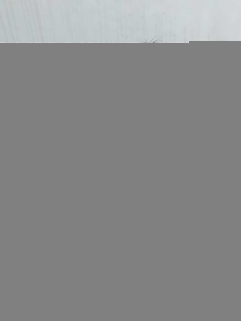 탈모약 복용 2주차