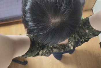 2개월차