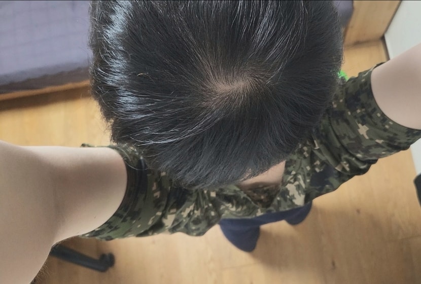 2개월차