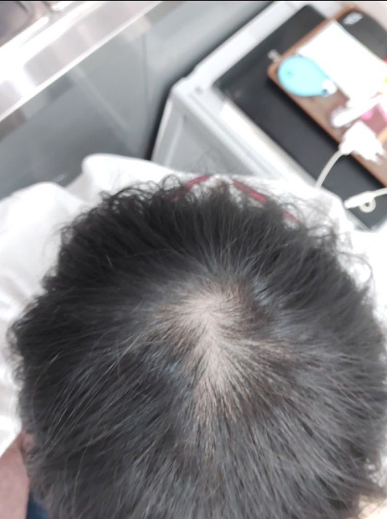 약 먹기전