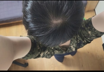 2개월차