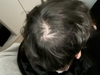 머리 대충 말리고 후레쉬 터뜨렸을때