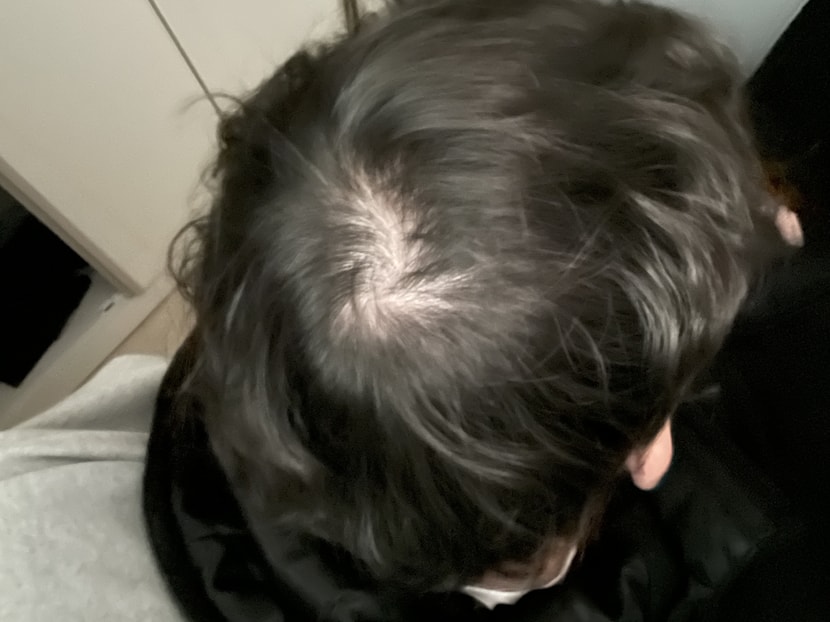 머리 대충 말리고 후레쉬 터뜨렸을때