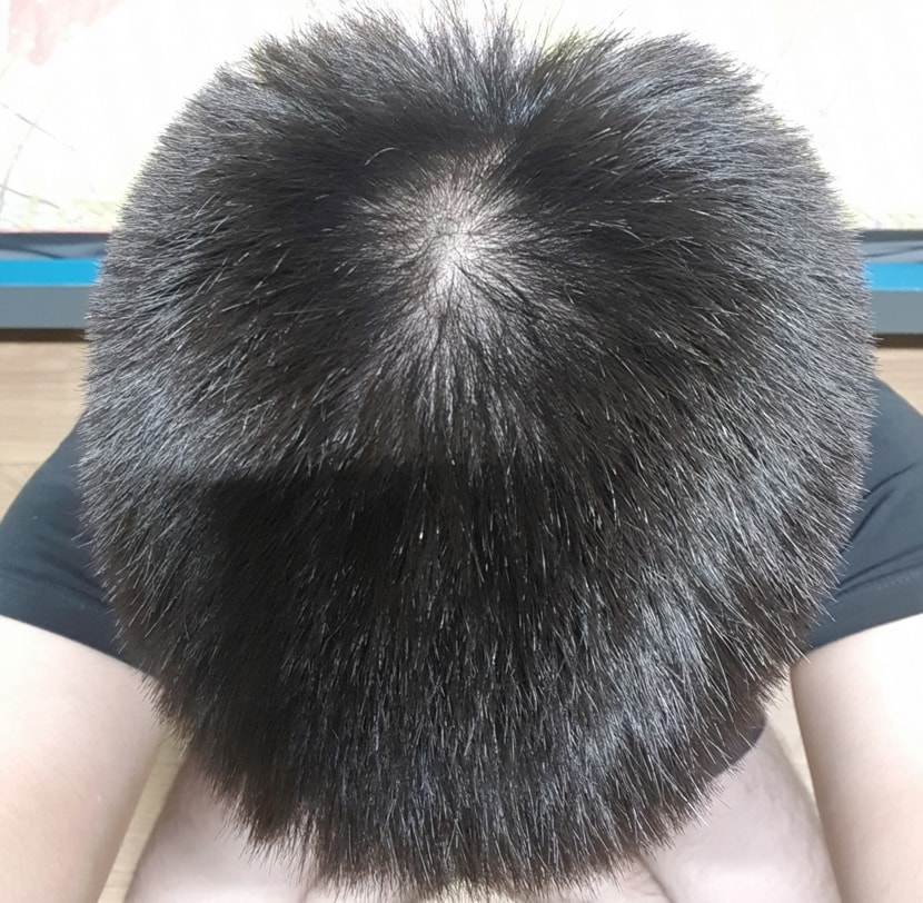 윗머리1
