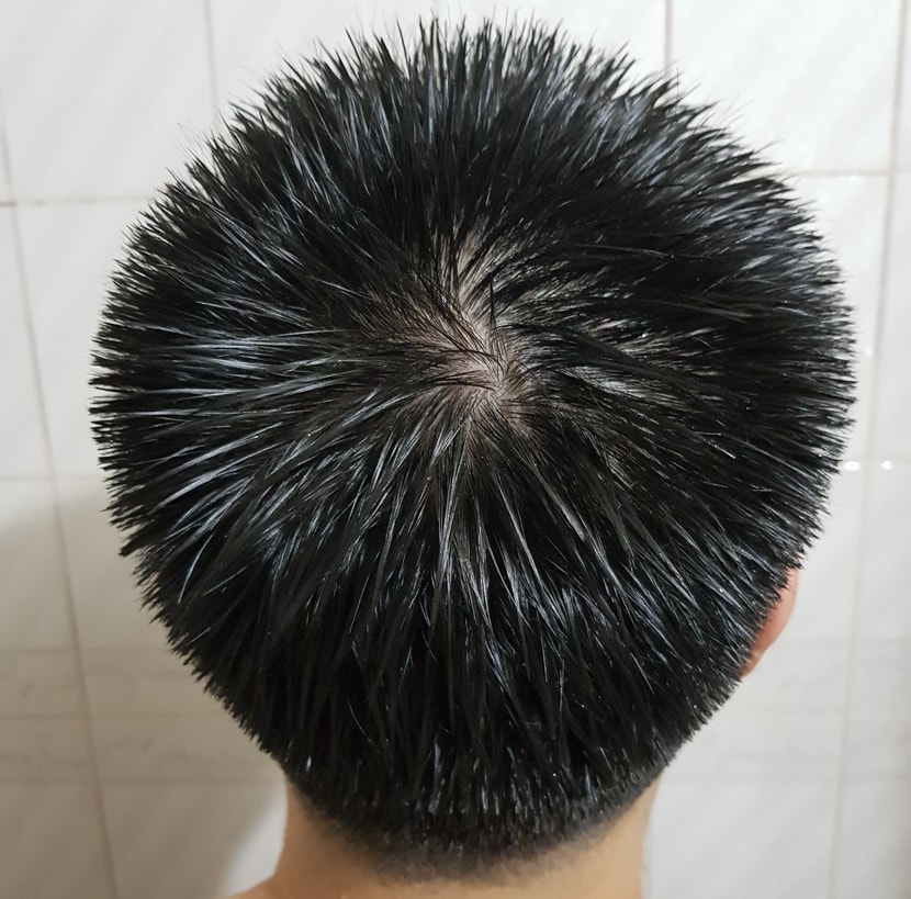 정수리3