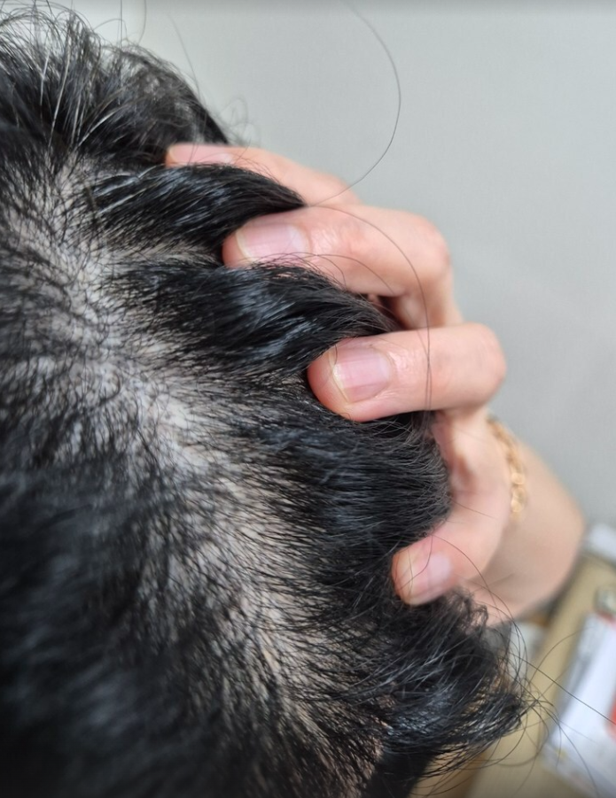 The second part of the 9th year hair loss Helchang's advanced know-how, I'll let you know in 3 minutes.