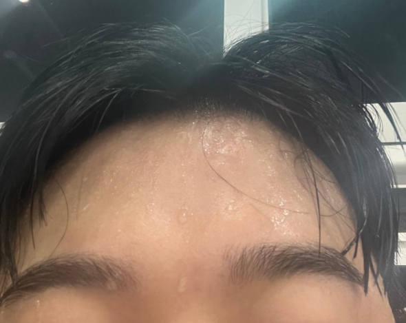 내 머머리
