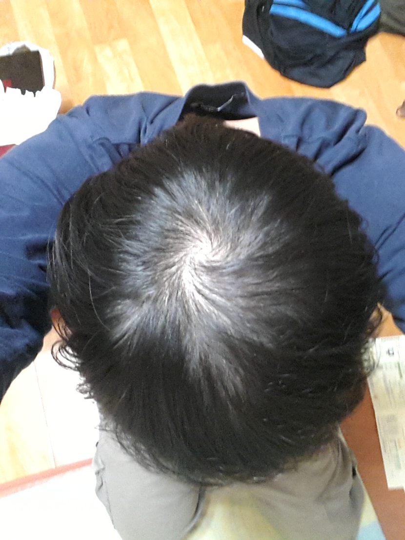 샴푸 1달째사진