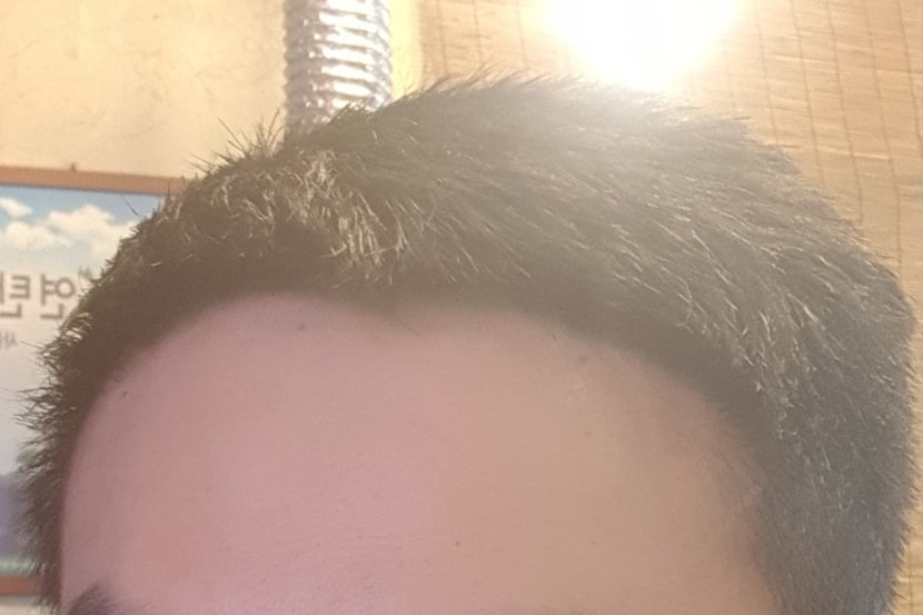 흑채사용 이후 모습입니다.
