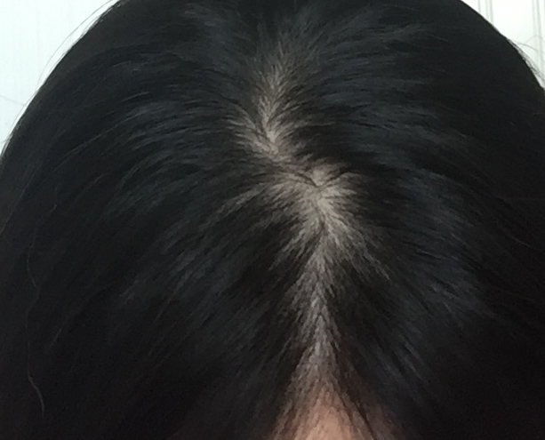 두피클리닉 샴푸 좋을까요?..