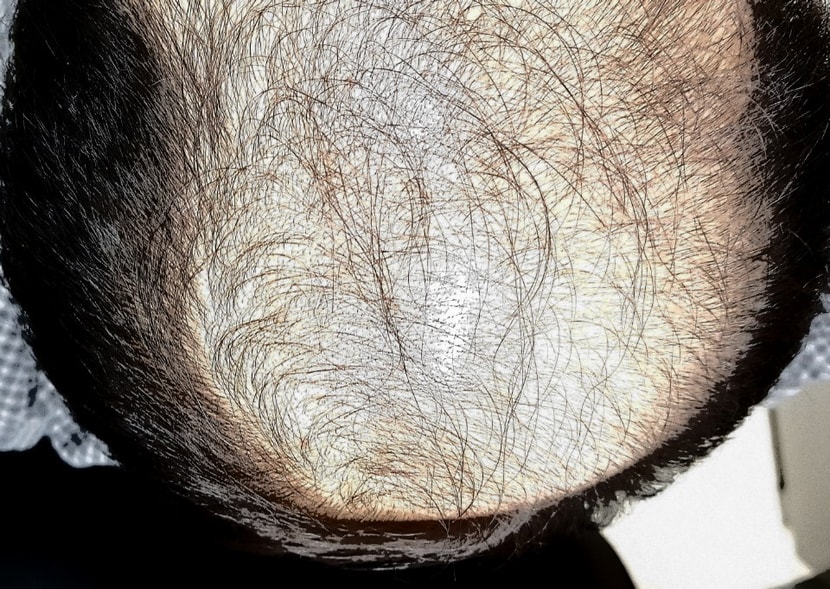 첫번째 한달경가후 사진입니다. 기억나시죠?