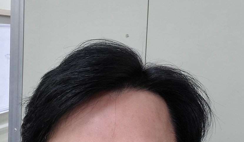 방금 찍은 셀카입니다 점심시간 훨씬 지났는데 떡안짐..떡지는 분들은 아실겁니다 오후되면 떡져서 머리내리면 달라붙고 올려도 앞머리 이마에 붙기시작ㅋㅋ 