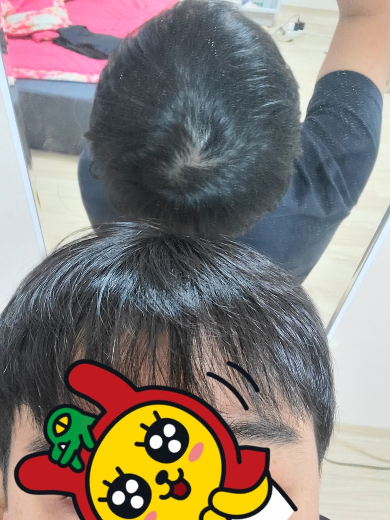 プロスカを食べています。