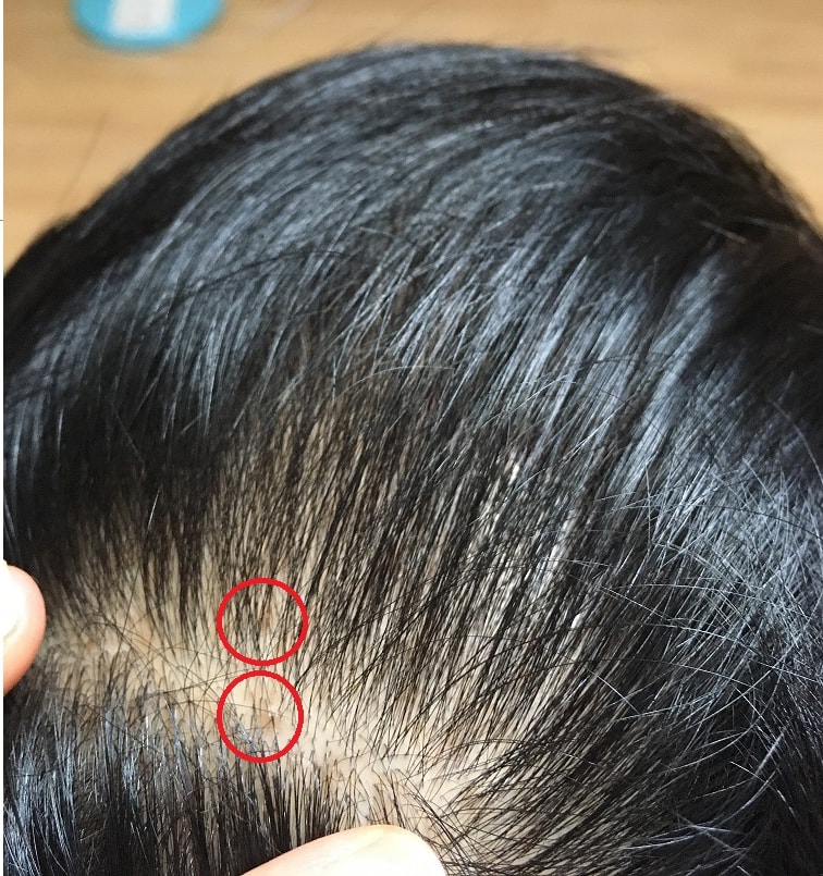 샴푸 추천 부탁드립니다.