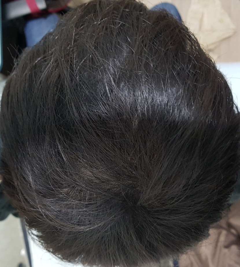 후