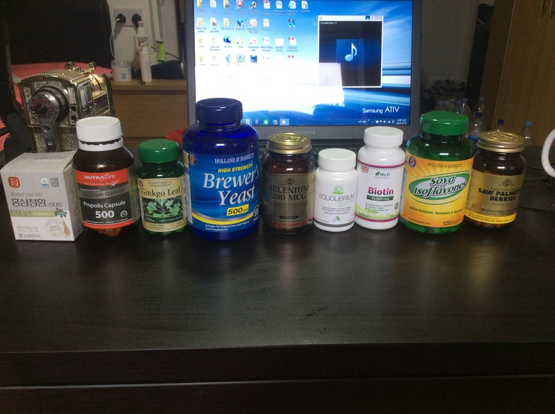 가입 첫 글. 프로페시아나 미녹시딜 이외의 치료 방안계획 중.