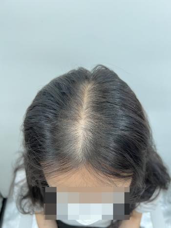 어디 지하철에 앉아있으면 여간 신경쓰이는게 아니에요..ㅠㅠ