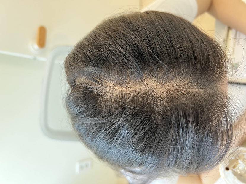 어디 지하철에 앉아있으면 여간 신경쓰이는게 아니에요..ㅠㅠ