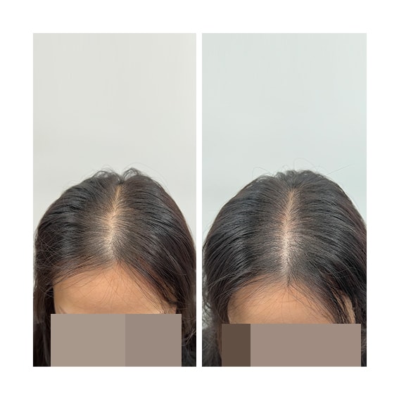 왼쪽이 비포, 오른쪽이 에프터에요