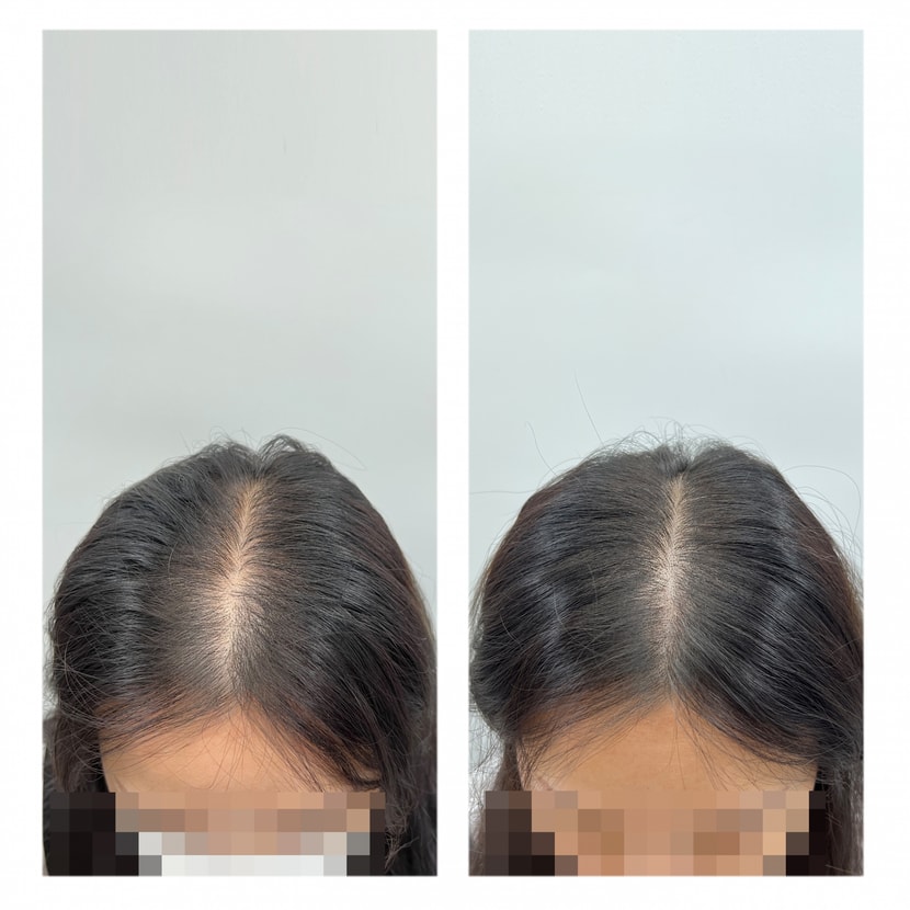 왼쪽이 비포 오른쪽이 에프터에요