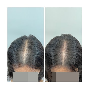 이미지로는 아주 약간 차이가 나는거 같아요