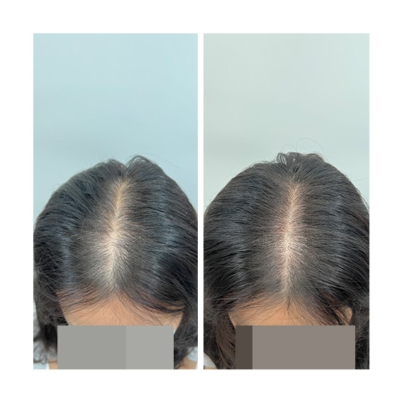 이미지로는 아주 약간 차이가 나는거 같아요