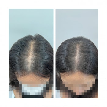 왼쪽이 비포 오른쪽이 에프터에요