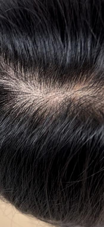 로게인폼 1주차