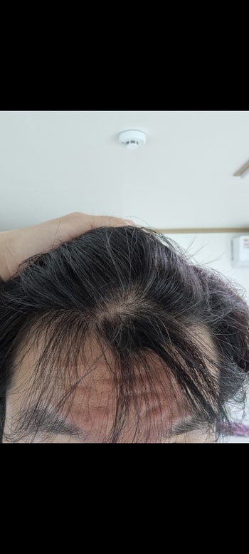 앞머리쪽
