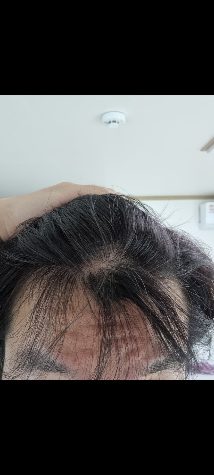 앞머리쪽
