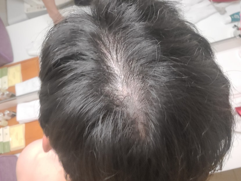 머리사진입니다